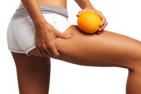 La cellulite conosci il tuo nemico, impara a combatterlo