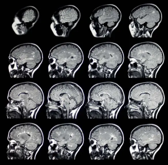 Dott. Loiacono Emilio Alessio Medico Chirurgo Medicina Chirurgia Estetica Benessere Dietologia Sessuologia Ecografie Tabagismo Smettere di fumare Cosa sente chi è in coma