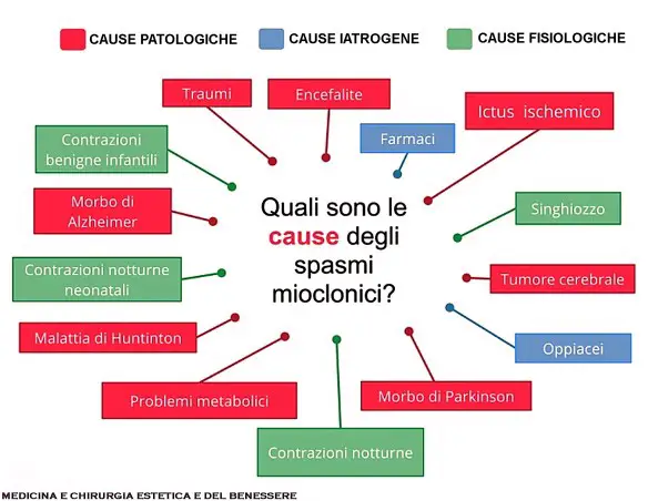 Dott Emilio Alessio Loiacono Medico Chirurgo SPASMI MUSCOLARI MIOCLONIE CONTRAZIONI Muscolo Dieta Chirurgia Medicina Estetica Roma Cavitazione Pressoterapia Grasso Dietologo Cellulite Calorie Peso Pancia Sessuologia Pene Laser Filler Rughe Botulino 2