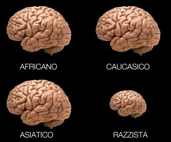 Dott Emilio Alessio Loiacono Medico Chirurgo Specialista in Medicina Estetica CERVELLI NON SONO TUTTI UGUALI Roma Cavitazione Pressoterapia Grasso Linfodrenante Dietologo Cellulite Calorie Pancia Sessuologia Sesso Pene HD Laser Filler Rughe Botulino