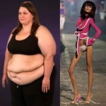 Dott Emilio Alessio Loiacono Medico Chirurgo Estetico Medicina Estetica Roma IO DICO NO ALL'ORGOGLIO CURVY Grasso Obesità Anoressia Rughe Cavitazione Cellulite Pulsata Peeling Pressoterapia Linfodrenante Mappatura Nei Dietologo Dermatologia