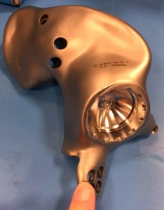 Dott Emilio Alessio Loiacono Medico Chirurgo Estetico Medicina Estetica Roma PRIMO TRAPIANTO BACINO MONDO TORINO OSSA TUMORE  Radiofrequenza Rughe Cavitazione Cellulite Pulsata Peeling Pressoterapia Linfodrenante Mappatura Nei Dietologo Dermatologia