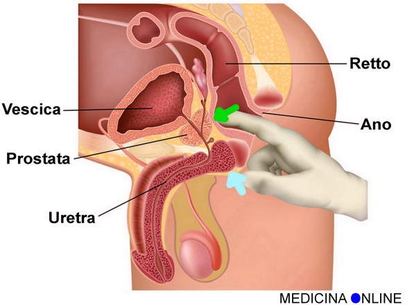 MEDICINA ONLINE PENE PROSTATA PUNTO L L POINT SEX SESSO VAGINA PARETE ANTERIORE ANO MASSAGGIO PROSTATICOTANTRA VULVA CLITORIDE STIMOLAZIONE VIDEO TOCCARE PREMERE DONNA WALLPAPER HI RES P
