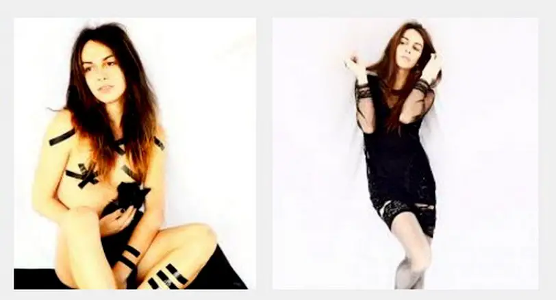 Dott Emilio Alessio Loiacono Medico Chirurgo Roma ALESSIA AMERI SINDROME DI MORRIS Riabilitazione Nutrizionista Dieta Medicina Estetica Cavitazione Radiofrequenza Ecografia Pulsata Macchie Pene Capillari Pressoterapia Linfodrenaggi Antifumo