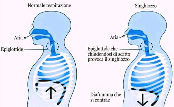 MEDICINA ONLINE Dott Emilio Alessio Loiacono Medico Chirurgo Roma PERCHE ABBIAMO SINGHIOZZO PASSARE Riabilitazione Nutrizionista Dieta Medicina Estetica Cavitazione Radiofrequenza Ecografia Pulsata Macchie Pene Capillari Pressoterapia Linfodrenaggi Antifumo