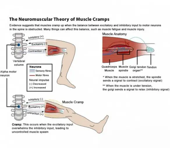 PERCHE VENGONO CRAMPI PREVENIRLI CURARLI Medicina Estetica Riabilitazione Nutrizionista Grasso Cavitazione Radiofrequenza Ecografi Seno Pene Massaggio Dieta Dimagrire Proteine Muscoli Palestra