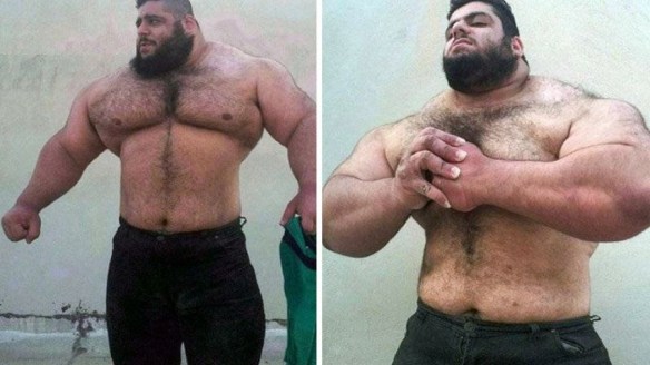 MEDICINA ONLINE Dott Emilio Alessio Loiacono Medico Chirurgo Roma INCREDIBILE HULK SAJAD GHARI Tradimento Riabilitazione Nutrizionista Dieta Medicina Estetica Cavitazione Radiofrequenza Ecografia Seno Pulsata  Macchie Capillari Linfodrenaggio.jpg