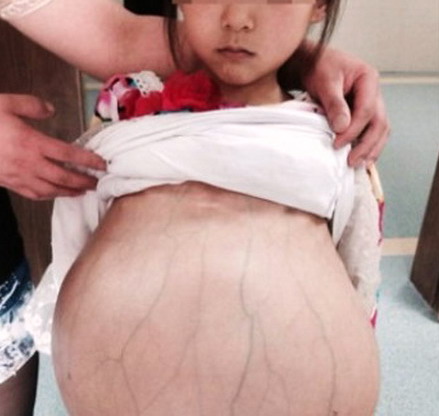 MEDICINA ONLINE Dott Emilio Alessio Loiacono Medico Chirurgo Roma MOGLIE 12 ANNI INCINTA Riabilitazione Nutrizionista Medicina Estetica Cavitazione Radiofrequenza Ecografia Pulsata Macchie Capillari Linfodrenaggio Pene Vagina