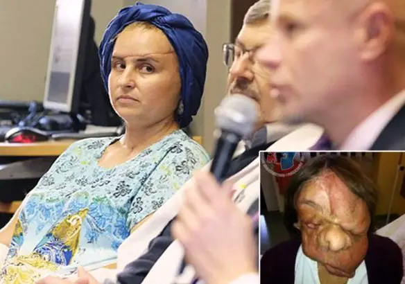 MEDICINA ONLINE Dott Emilio Alessio Loiacono Medico Chirurgo Roma NEUROFIBROMATOSI TRAPIANTO FACCIA Riabilitazione Nutrizionista Medicina Estetica Cavitazione Radiofrequenza Ecografia Pulsata Macchie Capillari Linfodrenaggio Pene Vagina Ano