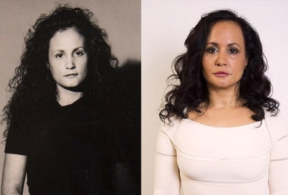 MEDICINA ONLINE Dott Emilio Alessio Loiacono Medico Chirurgo Roma DONNA NON RIDE DA 40 ANNI RUGHE VOLTO  Riabilitazione Nutrizionista Infrarossi Accompagno Commissioni Cavitazione Radiofrequenza Ecografia Pulsata  Macchie Capillari Ano Pene.jpg