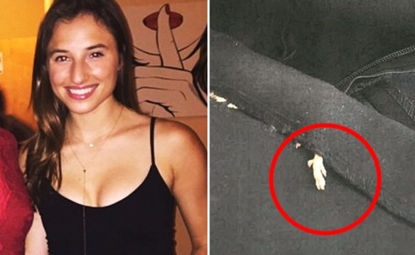 MEDICINA ONLINE Dott Emilio Alessio Loiacono Medico Chirurgo Roma TROVA TOPO MORTO IN VESTITO ZARA  Riabilitazione Nutrizionista Infrarossi Accompagno Commissioni Cavitazione Radiofrequenza Ecografia Pulsata  Macchie Capillari Ano Pene.jpg