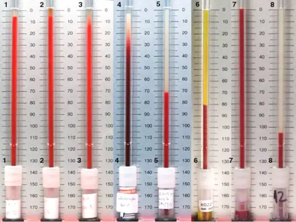 MEDICINA ONLINE Dott Emilio Alessio Loiacono Medico Chirurgo Roma VES ALTA BASSA CAUSE SINTOMI VALORI Riabilitazione Nutrizionista Medicina Estetica Cavitazione Radiofrequenza Ecografia Pulsata Macchie Capillari Linfodrenaggio Pene Vagina