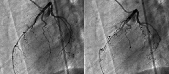 MEDICINA ONLINE Dott Emilio Alessio Loiacono Medico Chirurgo Roma CORONAROGRAFIA COSE COME FA PREPARAZIONE Riabilitazione Nutrizionista Infrarossi Accompagno Commissioni Cavitazione Radiofrequenza Ecografia Pulsata  Macchie Capillari Ano Pene.jpg