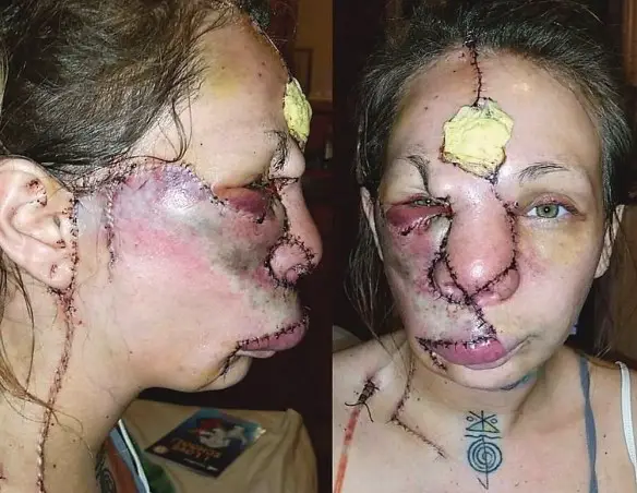 MEDICINA ONLINE Dott Emilio Alessio Loiacono Medico Chirurgo Roma INTERVENTO CHIRURGICO VOLTO SALVARE VITA Riabilitazione Nutrizionista Infrarossi Accompagno Commissioni Cavitazione Radiofrequenza Ecografia Pulsata  Macchie Capillari Ano Pene.jpg