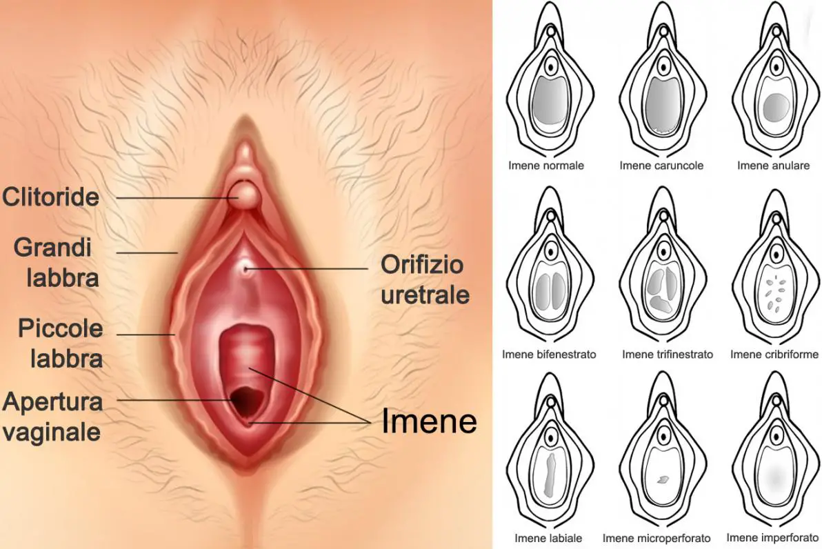 Restare incinta vergine senza penetrazione è possibile? | MEDICINA ONLINE