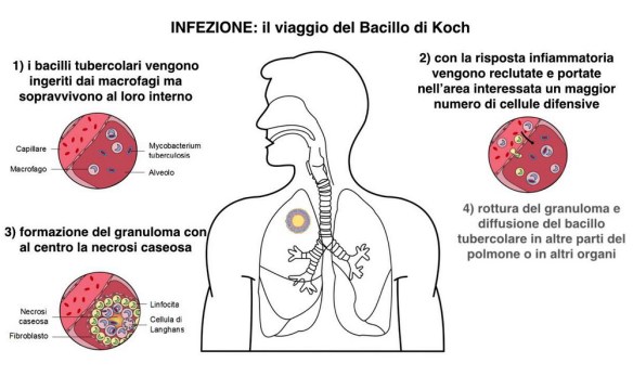 MEDICINA ONLINE Dott Emilio Alessio Loiacono Medico Chirurgo Roma TUBERCOLOSI ITALIA DIFFONDENDO STRANIERI Riabilitazione Nutrizionista Infrarossi Accompagno Commissioni Cavitazione Radiofrequenza Ecografia Pulsata  Macchie Capillari Ano Pene.jpg