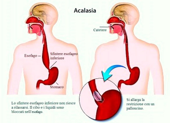 MEDICINA ONLINE Dott Emilio Alessio Loiacono Medico Chirurgo Roma FEMORE ROTTO TIPI FRATTURA INTERVENTO Riabilitazione Nutrizionista Infrarossi Accompagno Commissioni Cavitazione Radiofrequenza Ecografia Pulsata Macchie Capillari Ano Pene