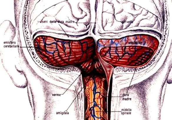 MEDICINA ONLINE Dott Emilio Alessio Loiacono Medico Chirurgo Roma CERVELLETTO LESIONI CEREBELLARI COMUNI Riabilitazione Nutrizionista Infrarossi Accompagno Commissioni Cavitazione Radiofrequenza Ecografia Pulsata  Macchie Capillari Ano Pene.jpg