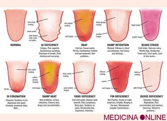 MEDICINA ONLINE Dott Emilio Alessio Loiacono Medico Chirurgo Roma LINGUA BIANCA IMPASTATA PERICOLOSA CAUSE Riabilitazione Nutrizionista Infrarossi Accompagno Commissioni Cavitazione Radiofrequenza Ecografia Pulsata Macchie Capillari Ano Pene
