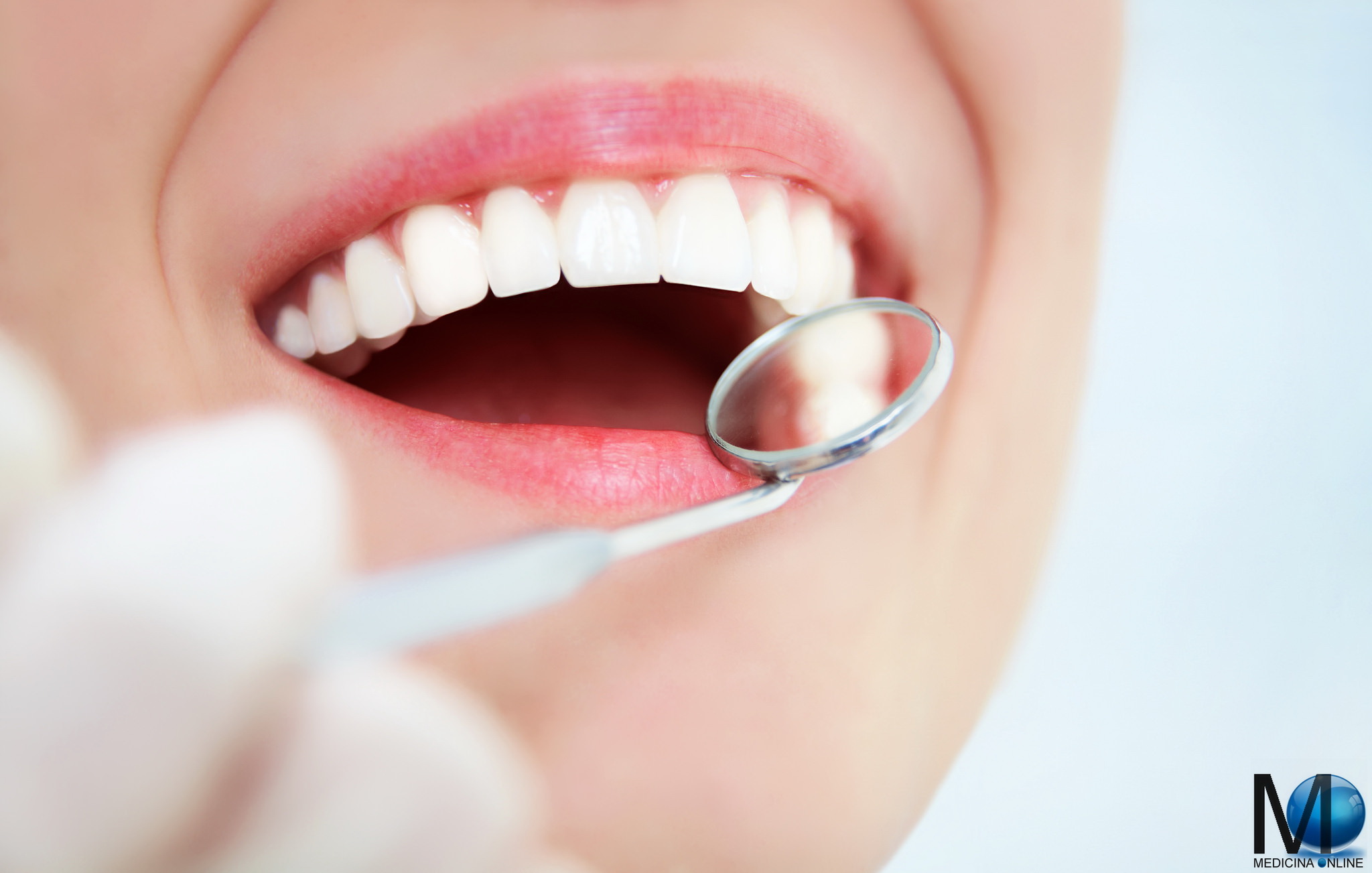 MEDICINA ONLINE DENTI BIANCHI CARIE TARTARO PUS ALITO ALITOSI DENTISTA IGIENE ORALE INCISIVI SPECCHIETTO BOCCA LABBRA DONNA