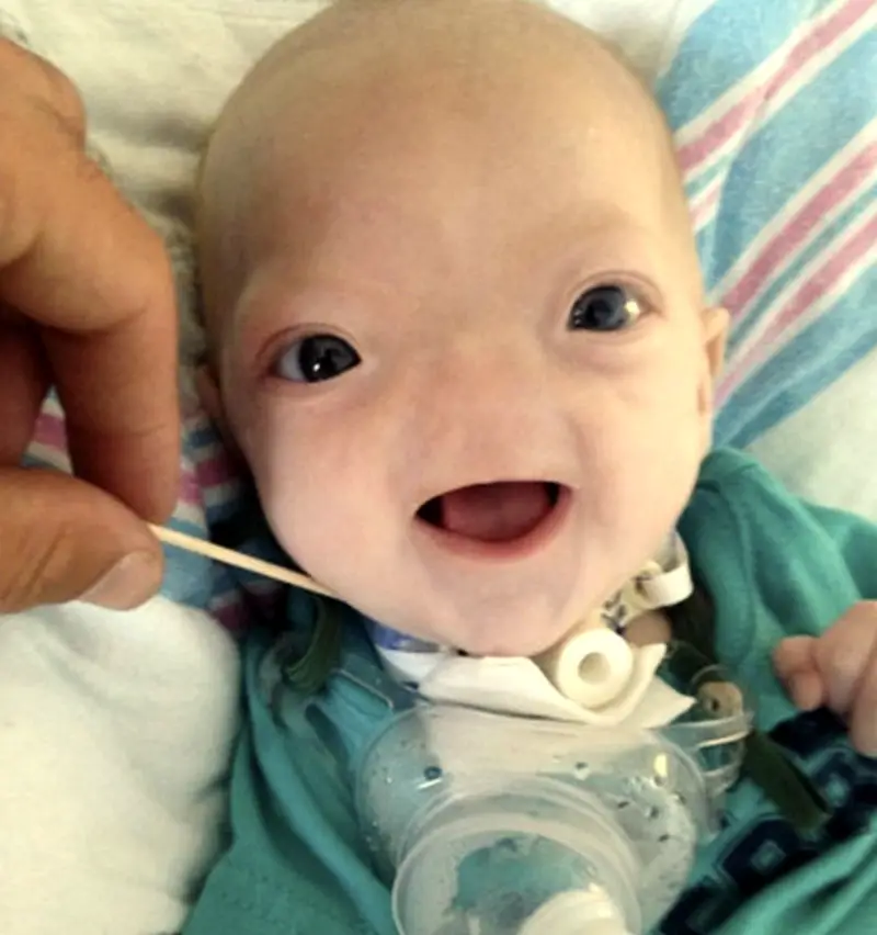 MEDICINA ONLINE Dott Emilio Alessio Loiacono Medico Chirurgo Roma ARINIA MANCANZA CONGENITA DEL NASO Riabilitazione Nutrizionista Infrarossi Accompagno Commissioni Cavitazione Radiofrequenza Ecografia Pulsata  Macchie Capillari Ano Pene.jpg