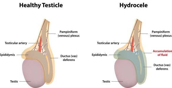 MEDICINA ONLINE SPERMA LIQUIDO SEMINALE VARICOCELE HYDROCELE IDROCELE AMORE DONNA PENE EREZIONE IMPOTENZA DISFUNZIONE ERETTILE VAGINA SESSULITA SESSO COPPIA LOVE COUPLE FRINEDS LOVER SEX GIRL MAN NO WOMAN WALLPAPER.jpg