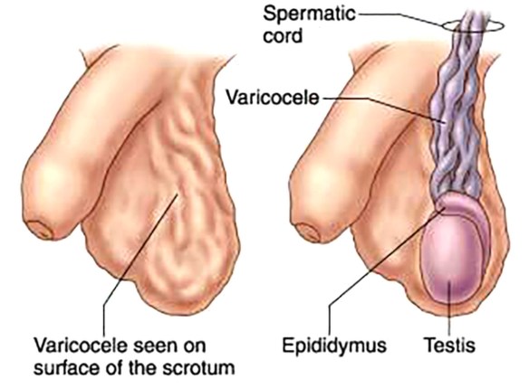 MEDICINA ONLINE SPERMA LIQUIDO SEMINALE VARICOCELE HYDROCELE IDROCELE AMORE DONNA PENE EREZIONE IMPOTENZA DISFUNZIONE ERETTILE VAGINA SESSULITA SESSO COPPIA LOVE COUPLE FRINEDS LOVER SEX GIRL MAN NO WOMAN WALLPAPER.jpg