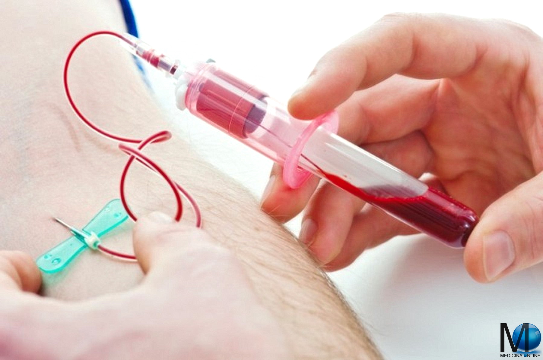 Volume corpuscolare medio (MCV) alto, basso, valori normali e