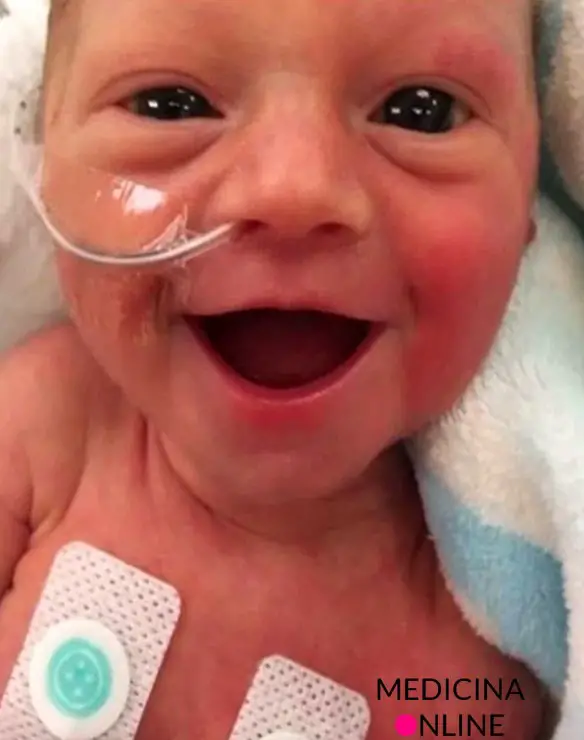 MEDICINA ONLINE Dott Emilio Alessio Loiacono Medico Chirurgo Roma LA VITA E' PREZIOSA Riabilitazione Nutrizionista Infrarossi Accompagno Commissioni Cavitazione Radiofrequenza Ecografia Pulsata  Macchie Capillari Ano Pene.jpg