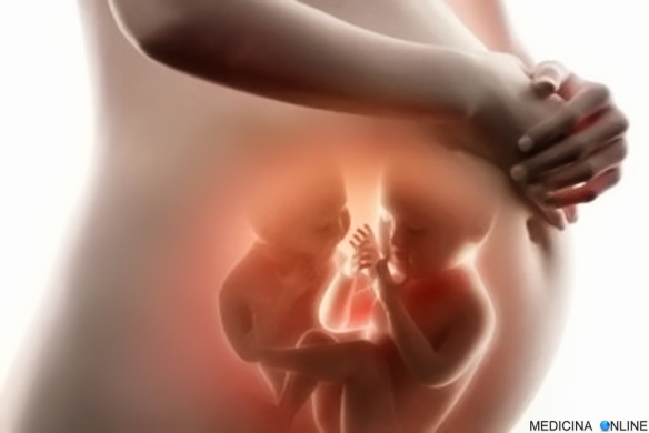 MEDICINA ONLINE EMILIO ALESSIO LOIACONO MEDICO CHIRURGO Fetus in fetu gemelli evanescenti e sindrome del gemello parassita gravidanza pancione maternità concepimento