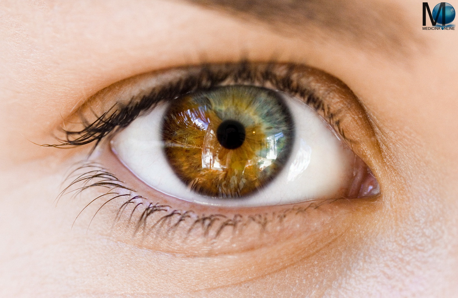 MEDICINA ONLINE OCCHIO OCCHI COLORE ETEROCROMIA OCCHI CON COLORE DIVERSO DIVERSITA CIGLIA PELI AZZURRI CASTANI CHIARI SCURI BIOTIPO FOTOTIPO SOLE PELLE SGUARDO VISTA VISIONE CIECO.jpg
