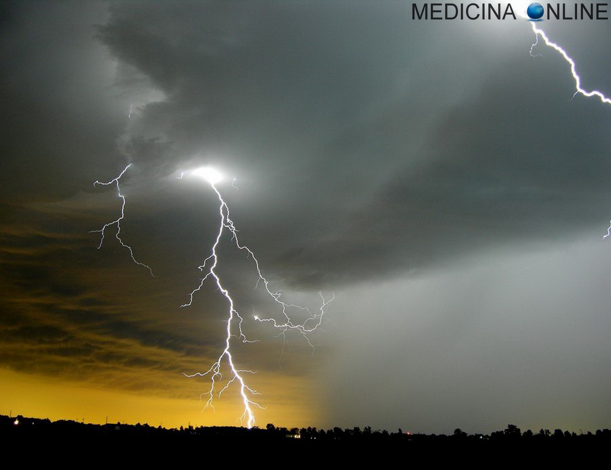 Pioggia come si forma, perché cade e quanti tipi esistono? MEDICINA