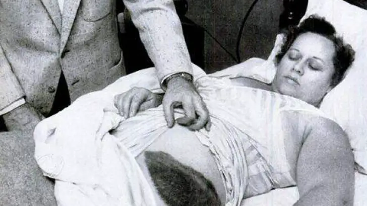 MEDICINA ONLINE ANN ELIZABETH HODGES METEORITE MONDO COLPITA MORTE