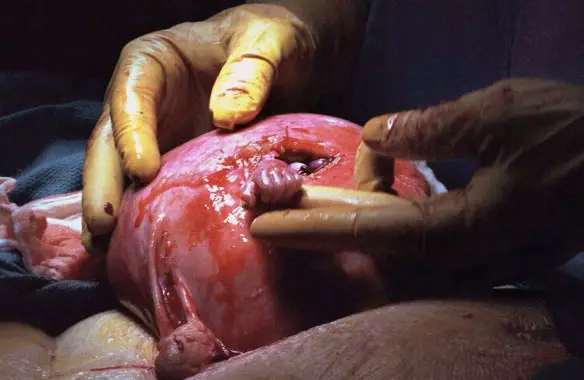 MEDICINA ONLINE Samuel Alexander Armas la mano della speranza HAND OF OPE PIC PHOTO FOTO PICTURE.jpg