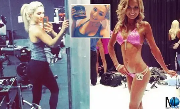 MEDICINA ONLINE MEEGAN HEFFORD RECORD DOPING PROTEINE MORTE INTEGRATORE BODY BUILDING 14 FARMACI ILLEGALI PROIBITI ANFETAMINE TREMBOLONE OBESO MUSCOLI FOTO PICTURE death-blamed-on-protein-shakes.jpg