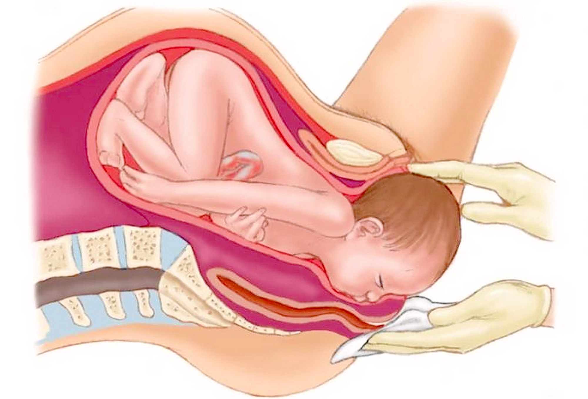 I termini &quot;aborto&quot; e &quot;morte intrauterina fetale&quot; (o &qu...