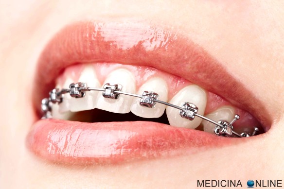 MEDICINA ONLINE LAVARSI I DENTI GENGIVE LINGUA LABBRA CORRETTAMENTE INCISIVI MOLARI PREMOLARI CANINI BAMBINI ADULTI DENTIFRICIO SPAZZOLARSI SPAZZOLINO MOVIMENTO COLLUTORIO FLUORO FILO INTERDENTALE BOCCA BAGNO TECNICA.jpg