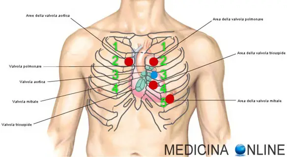 MEDICINA ONLINE SCHEMA SEMEIOTICA CUORE CARDIACA ESAME OBIETTIVO AUSCULTAZIONE FONENDOSCOPIO ORECCHIO FOCOLAIO SUCULTAZIONE POLMONARE AORTICO MITRALICO TRICUSPIDALE ERB INTERCOSTALE SPAZIO