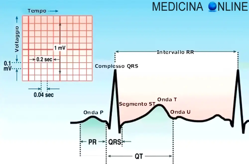 MEDICINA ONLINE ELETTROCARDIOGRAMMA ECG ESAME ONDE ONDA P T U COMPLESSO QRS SEGMENTO ST TRATTO INTERVALLO RR INTERPRETAZIONE SIGNIFICATO CUORE IMPULSO ELETTRICO NODO SENO ATRIALE SETTO ATRIO VENTRICOLO