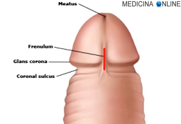 MEDICINA ONLINE FRENULO PENE EREZIONE FIMOSI CORTO ROTTO FRENULUM PENILE PENIS CIRCONCISIONE SESSO PENETRAZIONE VERGINITA GLANDE ASTA TESTA DEL PENE FILETTO SEX WALLPAPER PIC HD PICTURE ANATOMY ANATOMIA