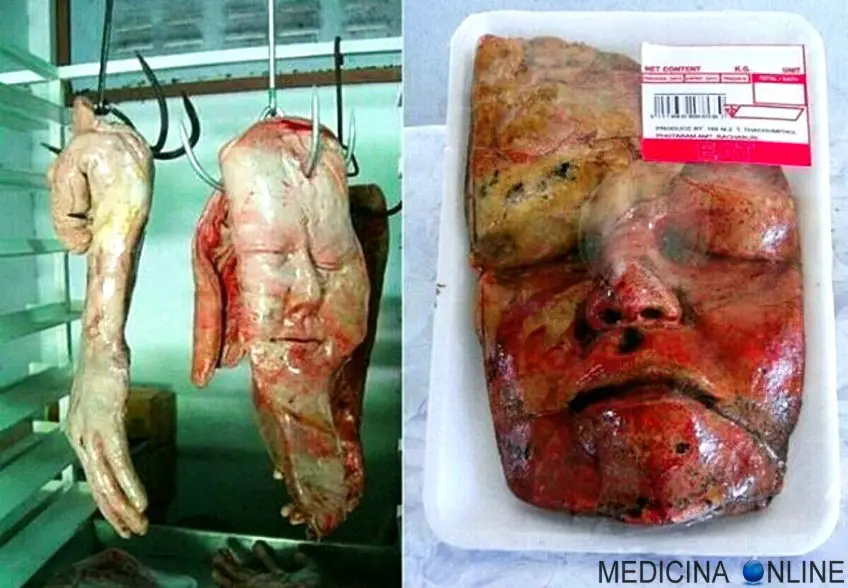MEDICINA ONLINE CARNE UMANA COMMESTIBILE MANGIARE MAIALE RISTORANTE GIAPPONESE CINESE ORIENTALE CANI GATTI UOMO FACCIA FOTO VENDUTA CADAVERE SCHIFO DISGUSTO BUFALA FALSO FACEBOOK