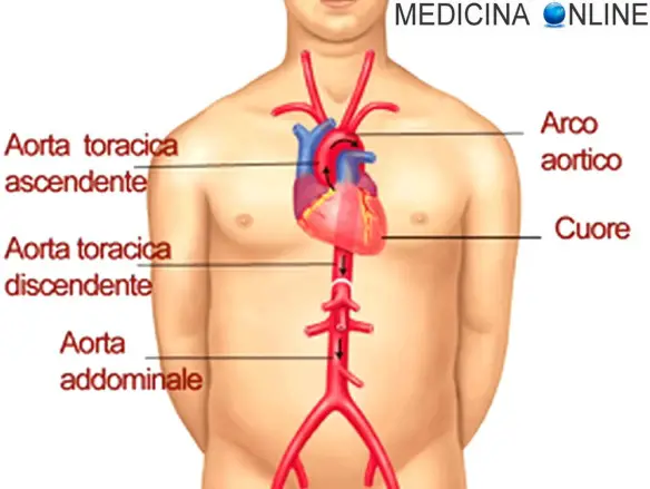 MEDICINA ONLINE CUORE AORTA TORACICA ADDOMINALE ASCENDENTE ARCO AORTICO DISCENDENTE RAMI GIUGULARE CAROTIDI CORONARIE ARTERIE VASI SANGUIGNI VASI.jpg