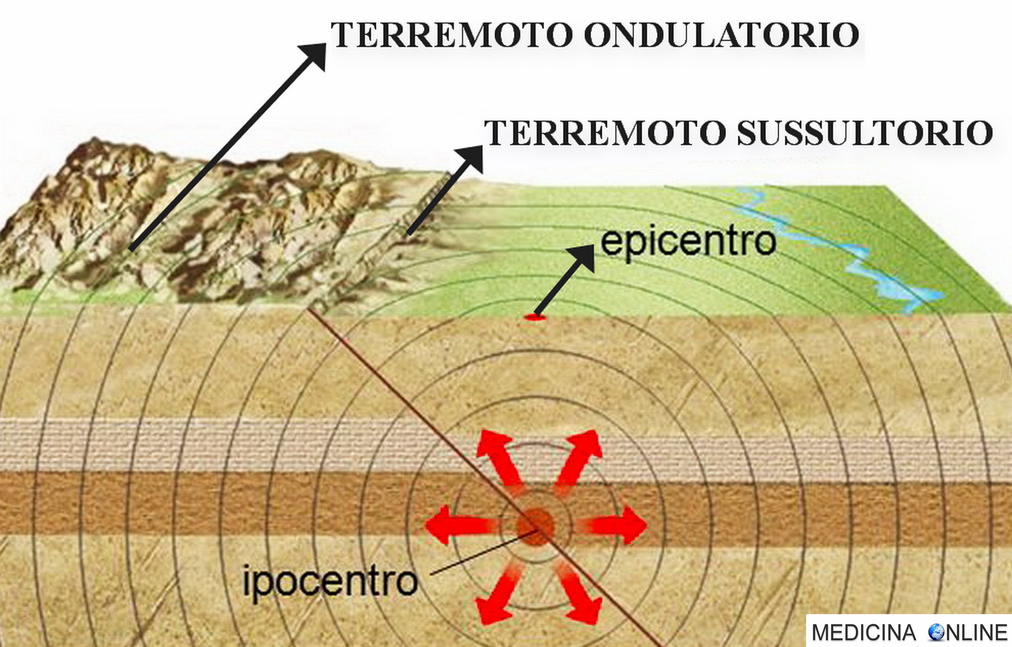 MEDICINA ONLINE DIFFERENZA TRA TERREMOTO ONDULATORIO E SUSSULTORIO MOVIMENTO LAMPADARIO SI MUOVE O NO ONDA SISMICA IPOCENTRO EPICENTRO MAGNITUDO SISMA OSCILLAZIONE SCOSSONE DESTRA SINISTRA ALTO BASSO.jpg