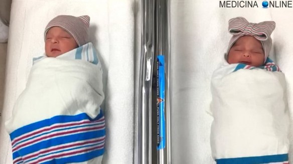 MEDICINA ONLINE FIGLI GEMELLI BIMBI NASCITA PARTO ANNI DIVERSI 2017 2018 Joaquin Jr. e Aitana de Jesus TWINS.jpg