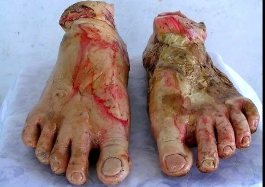 MEDICINA ONLINE Kittiwat Unarrom CARNE UMANA DI PANE HUMAN MEAT BREAD