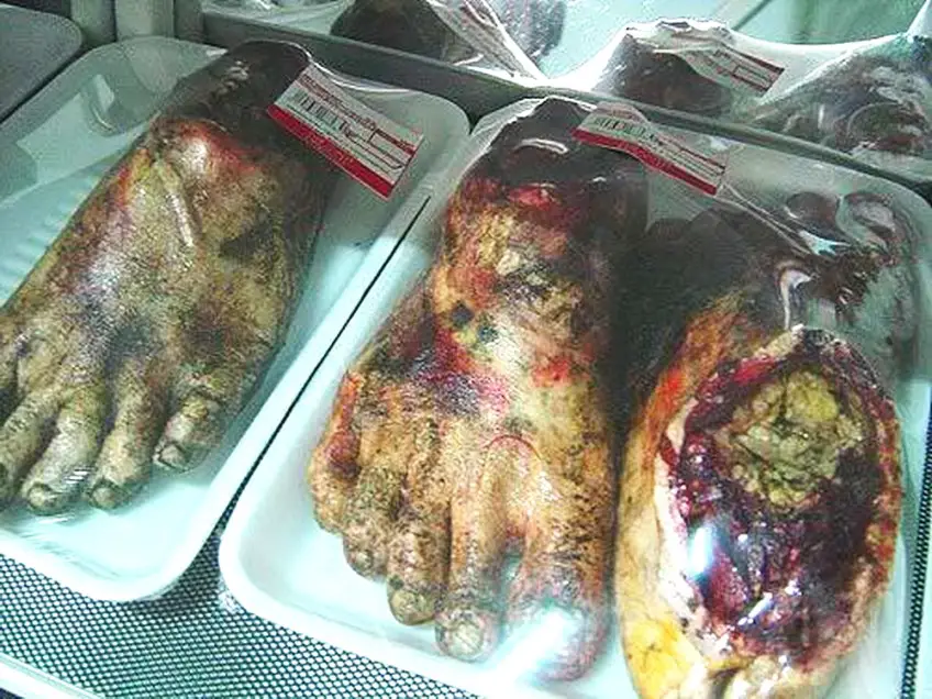 MEDICINA ONLINE Kittiwat Unarrom CARNE UMANA DI PANE HUMAN MEAT BREAD