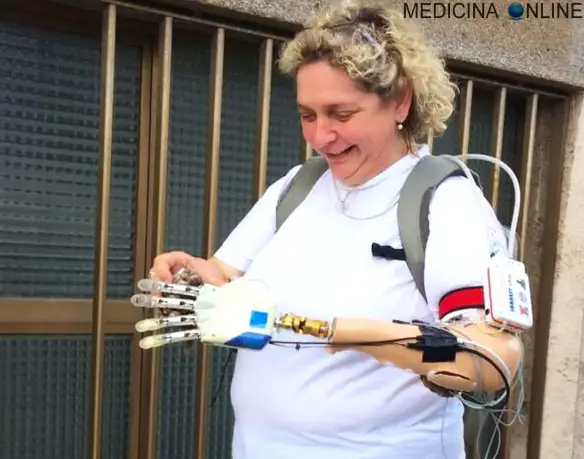 MEDICINA ONLINE MANO BIONICA Almerina Mascarello BIONIC HAND LEFT TRAUMA CHIRURGIA PROTESI BRACCIO TECNOLOGIA DISABILE DISABILITA ARTO.jpg