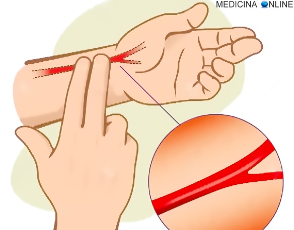 MEDICINA ONLINE POLSO RADIALE CUORE FREQUENZA CARDIACA BATTITI CARDIACI MISURARE NORMALI ALTI BASSI RIPOSO SFORZO Pulse Locations Carotid Pulse medial sternocleidomastoid