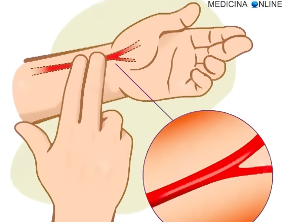 MEDICINA ONLINE POLSO RADIALE CUORE FREQUENZA CARDIACA BATTITI CARDIACI MISURARE NORMALI ALTI BASSI RIPOSO SFORZO  Pulse Locations Carotid Pulse medial sternocleidomastoid.jpg