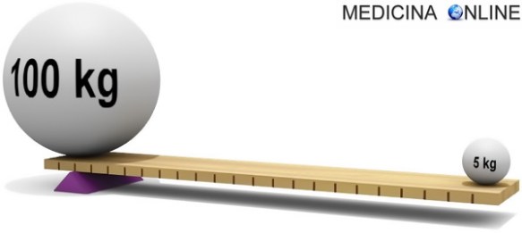 MEDICINA ONLINE DIFFERENZA LEVA DI PRIMO SECONDO TERZO TIPO GENERE VANTAGGIOSA SVANTAGGIOSA FULCRO POTENZA FORZA RESISTENZA ESEMPI datemi un punto d'appoggio e solleverò il mondo ARCHIMEDE.jpg